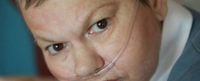 woman with oxygen tube in nostril looking in camera
