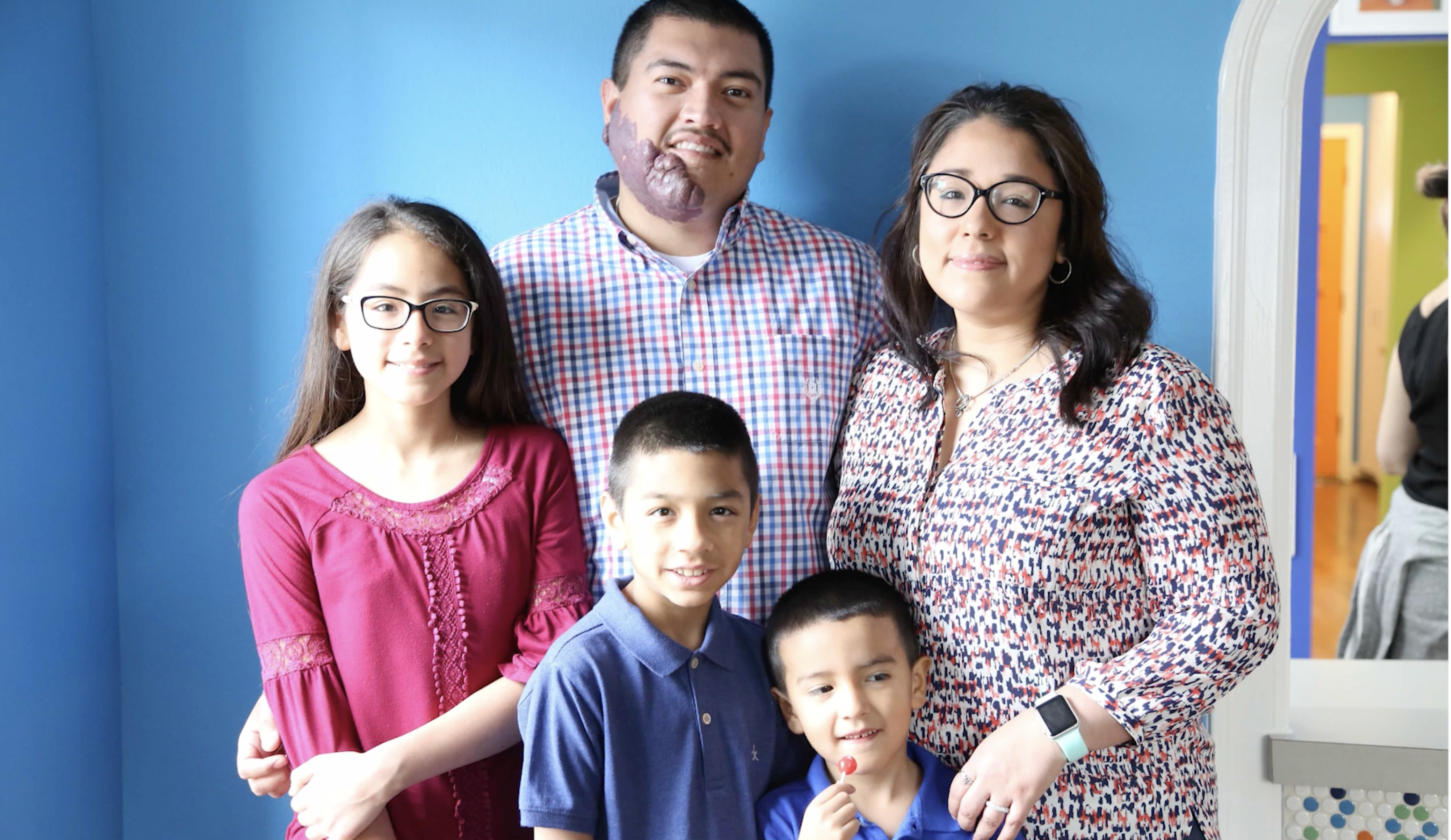 A young man in a plaid shirt with a birthmark on his cheek and chin, stands against a blue wall with his wife, daughter and 2 sons. They all have brown hair.