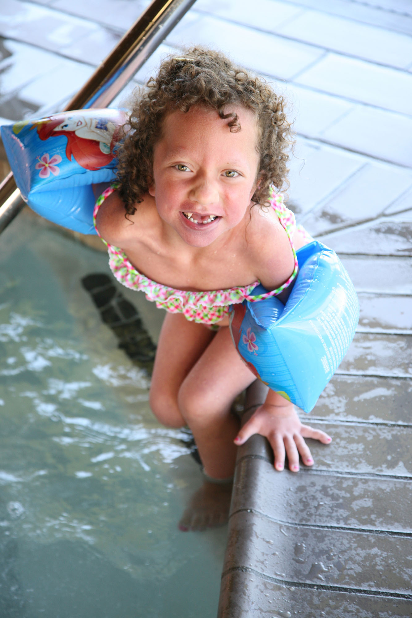 Abigail living with Noonan Syndrome