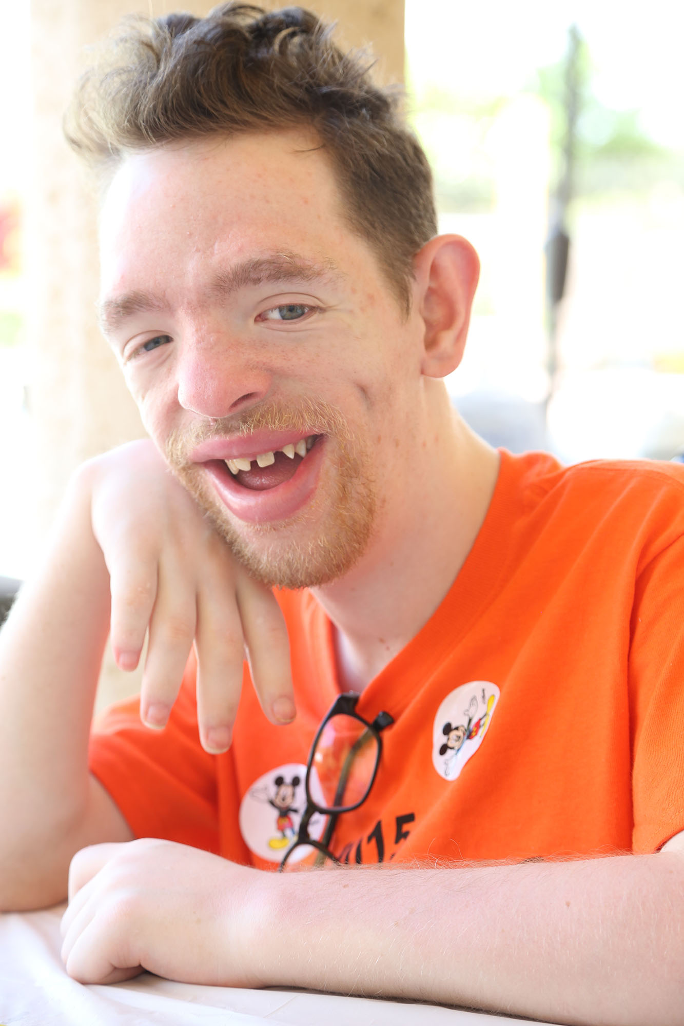 David living with Coffin Lowry Syndrome