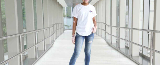 girl with Vitiligo poses in a hallway