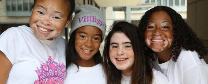 four girls with Vitiligo pose together closeup