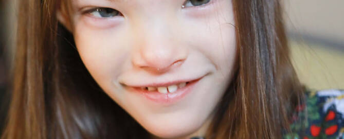 young girl with chromosome 5p- (Cri Du Chat) smiling into the camera, closeup photo