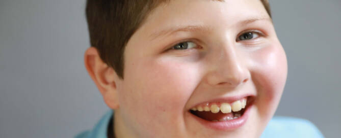 boy with Angelman Syndrome wearing blue shirt and smiling at the camera