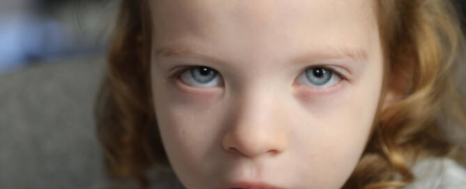 young girl with chromosome 5p- (Cri Du Chat) wearing grey shirt looking into the camera, closeup photo