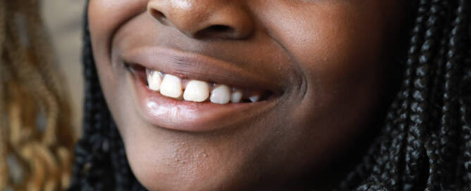 girl with Phelan-McDermid Syndrome smiling into the camera