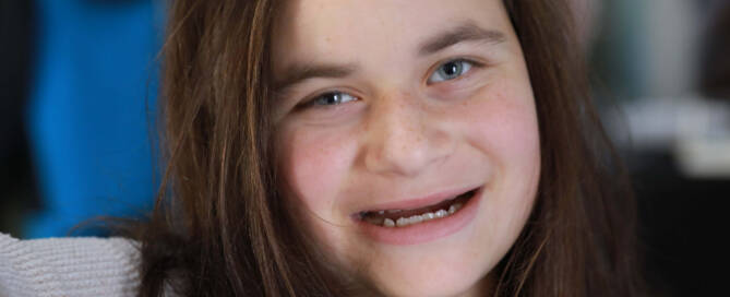 girl with Angelman Syndrome smiling into the camera, closeup photo