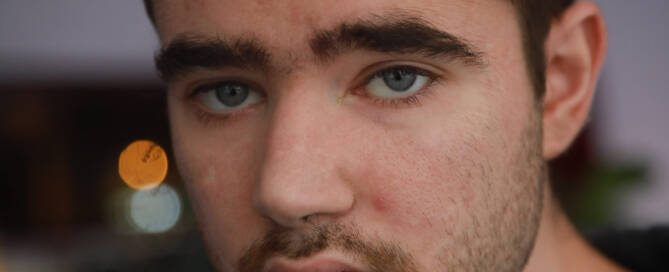 young man with Phelan-McDermid Syndrome looking deeply into the camera, closeup photo