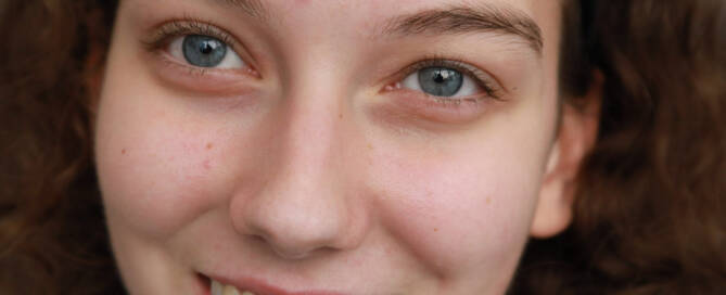 girl with Phelan-McDermid Syndrome looks into the camera while smiling, closeup photo