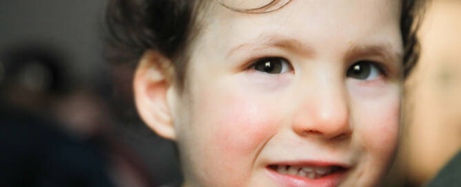 young girl with chromosome 5p- (Cri Du Chat) wearing grey shirt looking into the camera, closeup photo