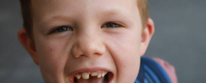 young boy with Phelan-McDermid Syndrome looks at the camera with a happy look on his face, closeup photo