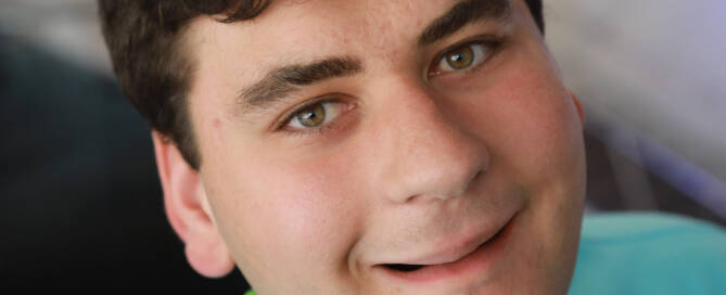 young man with Phelan-McDermid Syndrome looking into the camera and smiling, closeup photo