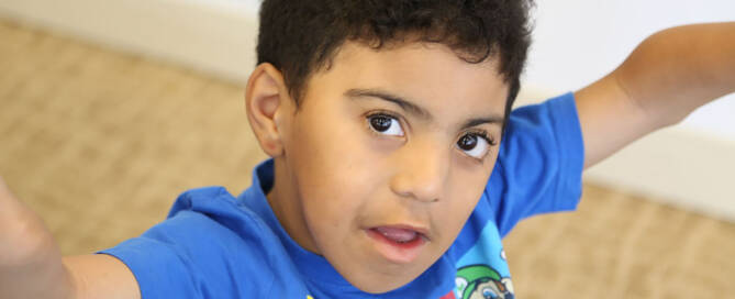 young boy with miller syndrome wearing blue shirt and looking into the camera