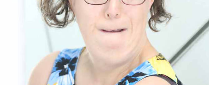 woman with miller syndrome wearing glasses looks into the camera