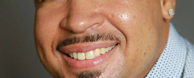 man with xxy syndrome smiling into the camera, close up photo