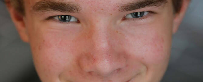 boy with xxy syndrome wearing flannel shirt smiling into the camera, closeup photo