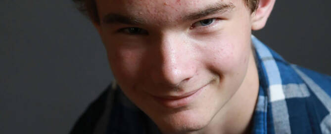 boy with xxy syndrome wearing flannel shirt smiling into the camera, closeup photo