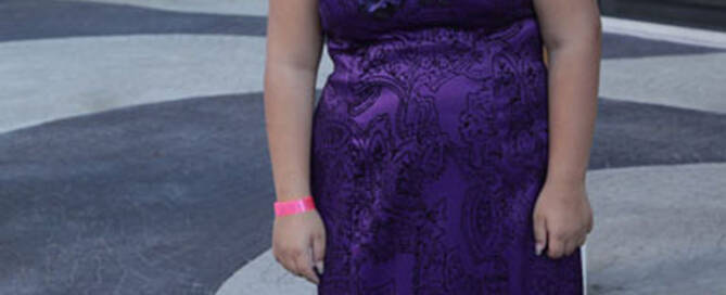 girl with turner syndrome wearing purple dress