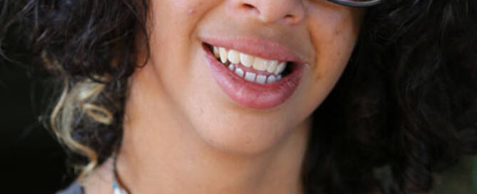 woman with williams syndrome wearing glasses and smiling at the camera