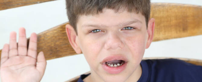 boy with williams syndrome sitting on wooden chair, close up photo