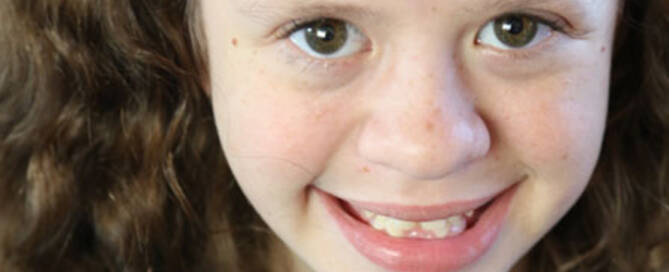 young girl with williams syndrome smiling into the camera