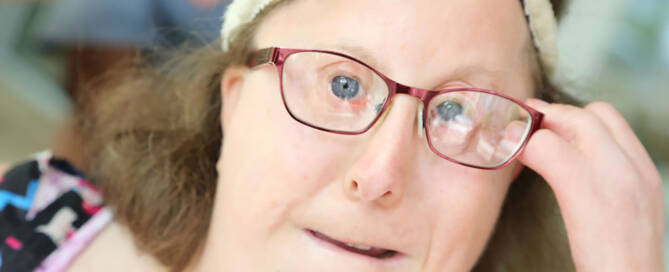 woman with miller syndrome adjusts her glasses while looking into the camera